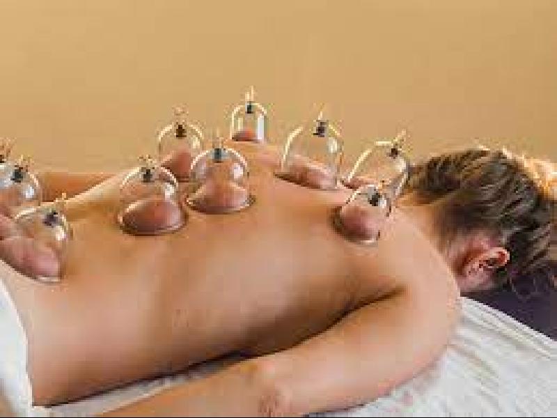 CUPPING THERAPY